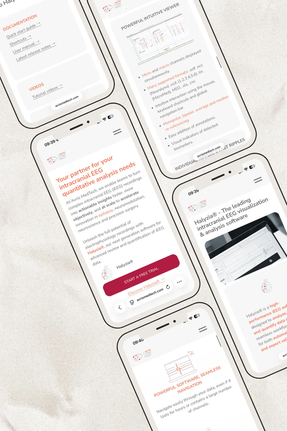 Site internet Avrio med tech, recherche sur l'épilepsie, version mobile, moderne.